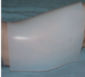 Plaque de BOLUSIL ® posée sur une jambe