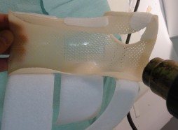 Chauffage d'une orthèse thermoformable