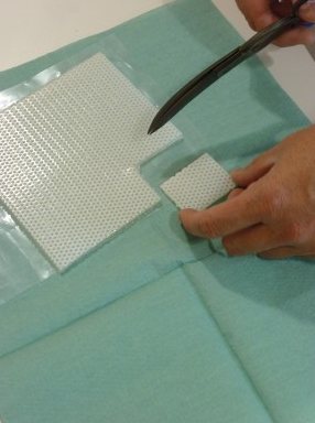Découpe aux ciseaux d'une plaque de silicone pour cicatrice